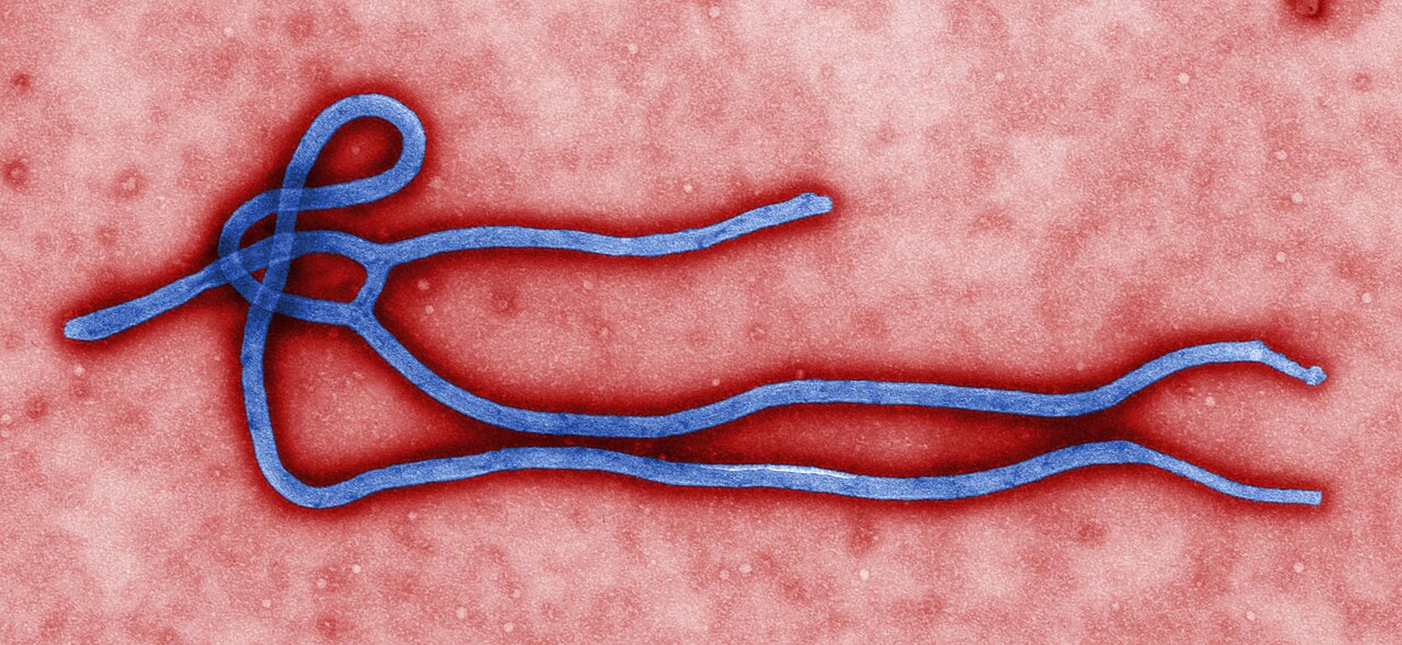 Colourised transmission electron micrograph of an Ebola virus virion.