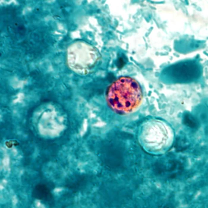 Microscopic image showing four Cyclospora cayetanensis oocysts.